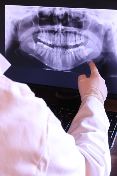 Best Tooth Infection Emergency Dentist  in Bishop, CA